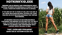 Fist corn and prolapse HOTKINKYJO