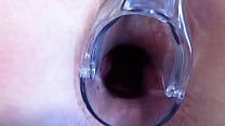 Stretching the anal and vagina with a gynecological speculum MILF with a big butt and a gaping asshole and a gaping pussy Stretching the anal and vagina with a gynecological speculum MILF with a big butt and a gaping asshole and a gaping pussy
