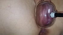 Using a pussy pump to swell my pussy lips and my swollen vagina Using a pussy pump to swell my pussy lips and my swollen vagina