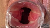 teen blonde sarah gyno speculum pussy gaping closeups and peeing teen blonde sarah gyno speculum pussy gaping closeups and peeing