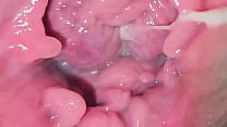 Exploring my vulva Exploring my vulva