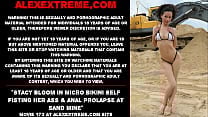 Stacy Bloom in micro bikini self fisting her ass  amp  anal prolapse at sand mine Stacy Bloom in micro bikini self fisting her ass  amp  anal prolapse at sand mine
