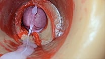 Female Insemination Internal Camera Captures Deep Male Huge Ejaculation