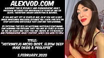 Hotkinkyjo micro skirt elbow deep huge dildo amp prolapse