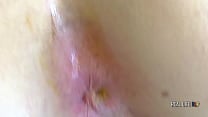 Real Life Porno 63 New Face Vanessa Leone First Anal Rimming amp Piss Swallowed Real Life Porno 63 New Face Vanessa Leone First Anal Rimming amp Piss Swallowed