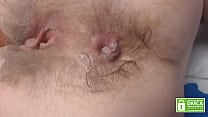 Dirty hairy ass fingering extreme close up Dirty hairy ass fingering extreme close up