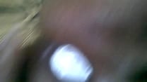 My Extreme Anal Insertion My Extreme Anal Insertion