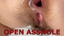 I wanted a small narrow hole in my ass and never gave it to anyone but I got my anus stretched I wanted a small narrow hole in my ass and never gave it to anyone but I got my anus stretched