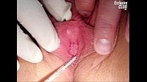 Teen Britney gyno pussy speculum exam