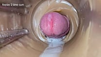 Camera Inside Deep Pussy Captures Huge Ejaculation of Sperm 2 times Camera Inside Deep Pussy Captures Huge Ejaculation of Sperm 2 times