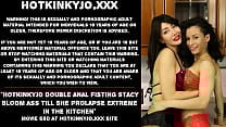 Hotkinkyjo double anal fisting Stacy Bloom ass till she prolapse extreme in the kitchen