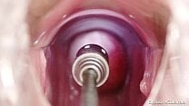 Hot blond babe vagina examination and enema Hot blond babe vagina examination and enema