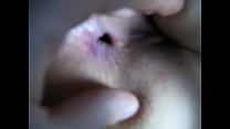 Examining my girls asshole