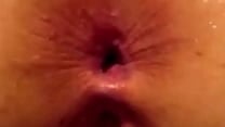 Husband Anal Fuck Wife Asshole Raw amp Crempie Inside Of Her