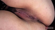 Doctor Mephisto closed up Naughty Masochist  039 s pussy with surgical staples