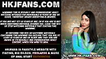 Amazing deep anal belly bulge fisting amp prolapse with huge dildo from mrhankeys done by Hotkinkyjo Amazing deep anal belly bulge fisting amp prolapse with huge dildo from mrhankeys done by Hotkinkyjo