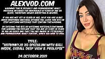 Hotkinkyjo XO speculum with ball inside  oxball deep view  fisting  amp  prolapse