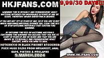Hotkinkyjo in black fishnet stockings fuck huge dildo from mrhankey anal gape fisting amp prolapse Hotkinkyjo in black fishnet stockings fuck huge dildo from mrhankey anal gape fisting amp prolapse