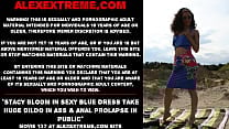 Stacy Bloom in sexy blue dress take huge dildo in ass amp anal prolapse in public