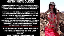 Hotkinkyjo with red tape self anal fisting amp prolapse on the lava rocks