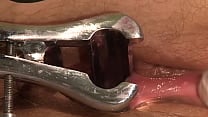 Dirty bitch needs to get punished in the medical room Part 2 She pissing on herself and loves when her gynecologist gets angry Dirty bitch needs to get punished in the medical room Part 2 She pissing on herself and loves when her gynecologist gets angry