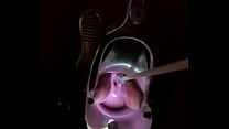 Fucking cervix w painful brush Fucking cervix w painful brush