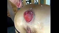 Porn Bizarre milf moms hardcore anal fisting Prolapse