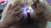 Sodomization and penetration in my asshole to make it bigger Sodomization and penetration in my asshole to make it bigger