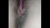 Casera