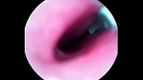 Camera inside my cock Camera inside my cock