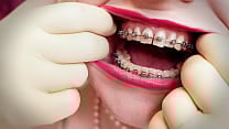 ASMR video MILF wearing double layer medical gloves and showing braces 4k video fetish sounding Arya Grander ASMR video MILF wearing double layer medical gloves and showing braces 4k video fetish sounding Arya Grander